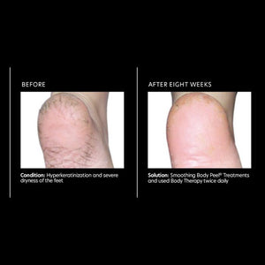 PCA Skin Body Therapy 7 oz - European Beauty by B