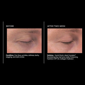 PCA Skin Ideal Complex® restorative eye cream 0.5 oz - European Beauty by B