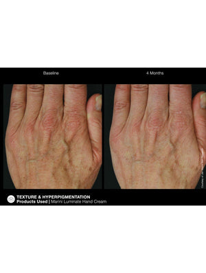 Jan Marini Marini ReNu Corrective Hand Complex - European Beauty by B