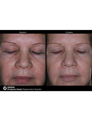 Jan Marini Regeneration Booster 1 oz