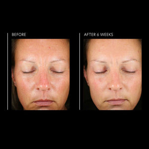 PCA Skin Hyaluronic Acid Overnight Mask 1.8 fl oz - European Beauty by B